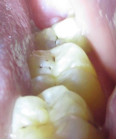 teeth-2.jpg